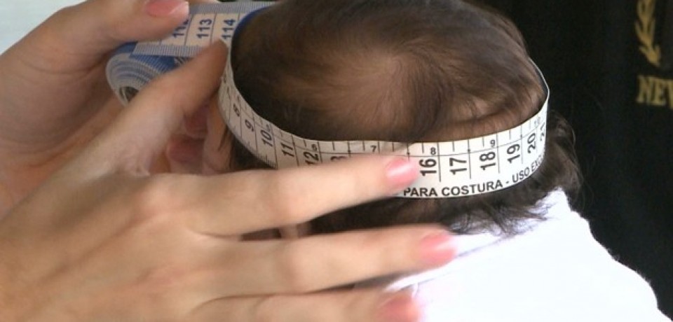 Celpe concede desconto para famílias de crianças com microcefalia